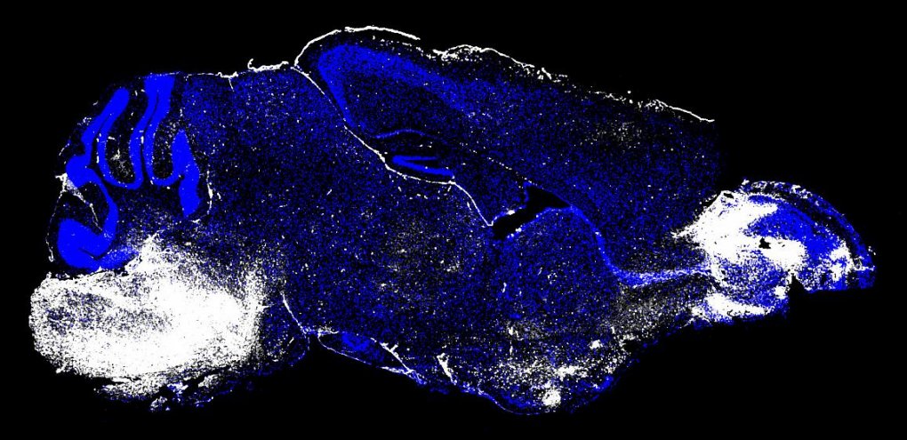 This image shows the brain of a mouse with cerebral malaria. There are white regions (to the left, on the brainstem and to the right, on the olfactory bulb) that indicate areas of neuronal cell death and vascular leakage