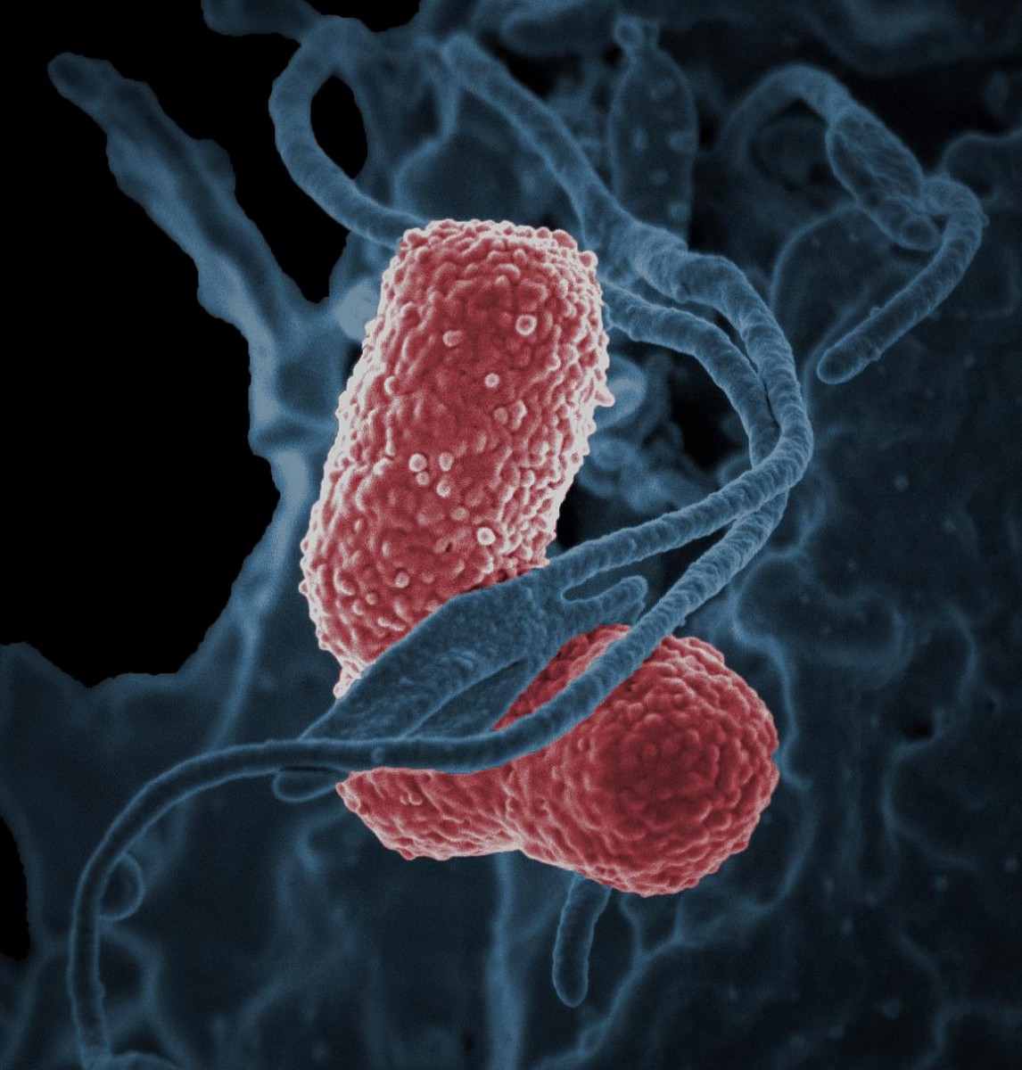 Klebsiella bacteria