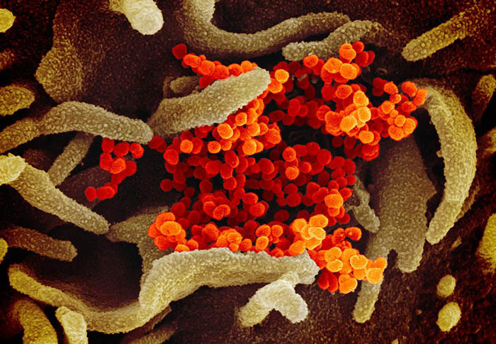 This scanning electron microscope image shows SARS-CoV-2 (orange)—also known as 2019-nCoV, the virus that causes COVID-19—isolated from a patient in the U.S., emerging from the surface of cells (green) cultured in the lab.