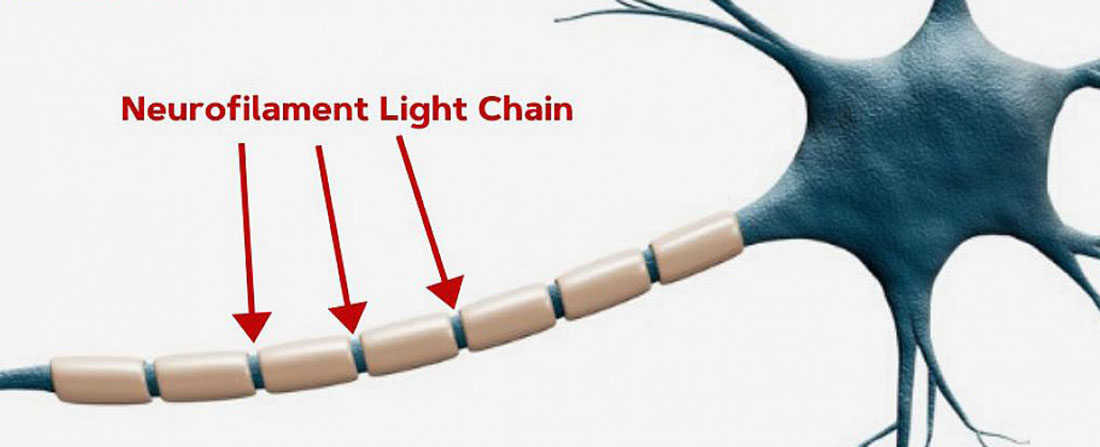 neurofilament light chain on a neuron