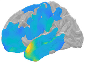  illustration of brain