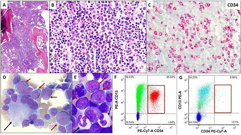 scientific images of bone marrow cells