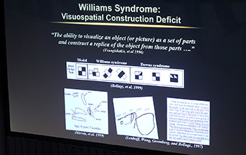 slide of Williams Syndrome--graphs and illustrations--from lecture