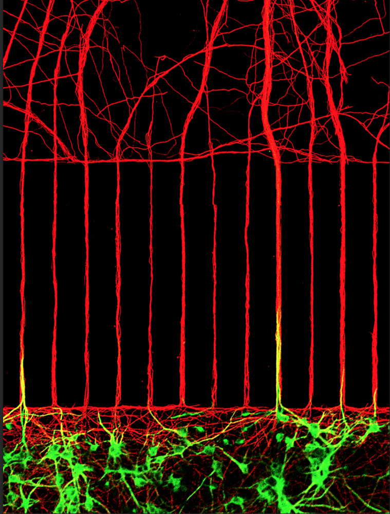 Neurons - axons and dendrites