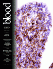 cover of the journal Blood with a purplish fuzzy looking cell