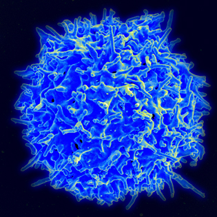 Magnified T lymphocyte--looks like hairy purple sphere