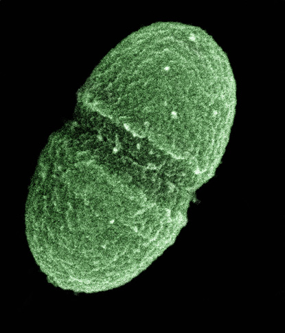  green microbe magnified