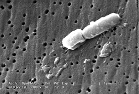 Black and white image of rod-like bacteria