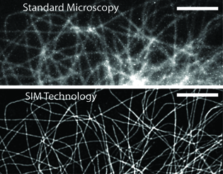  Top image is blurry strands; bottom image is a sharper image of the same strands