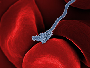 gray spiral-shape bacterium on red blood cells
