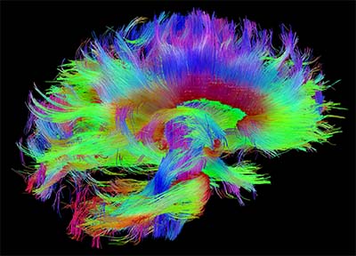 colorful whispy fibers in the shape of the brain