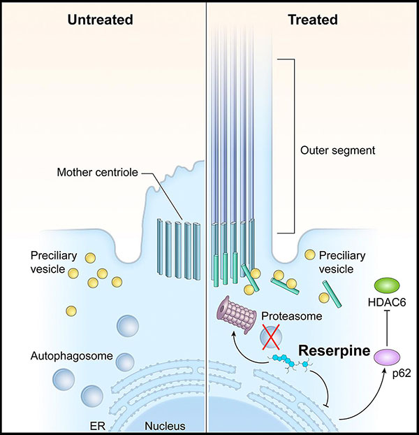diagram showing how reserpine keeps light-sensitive photoreceptors alive in models of Leber congenital amaurosis type 10