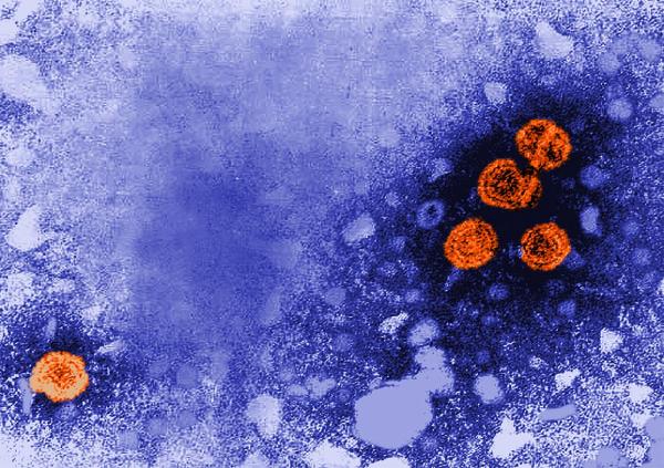 microscope image showing hepatitis B virus particles (orange)
