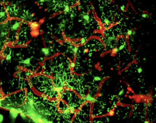 microglia (green) swarm around damaged blood vessels (red) in a mouse model of cerebrovascular injury