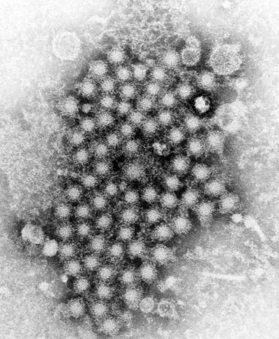hepatitis virus particles