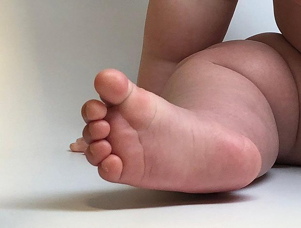 baby's foot and leg