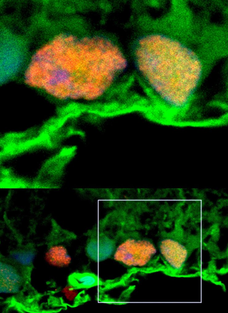 Microscopy shows exosomes (green) surrounding retinal ganglion cells (orange and yellow).