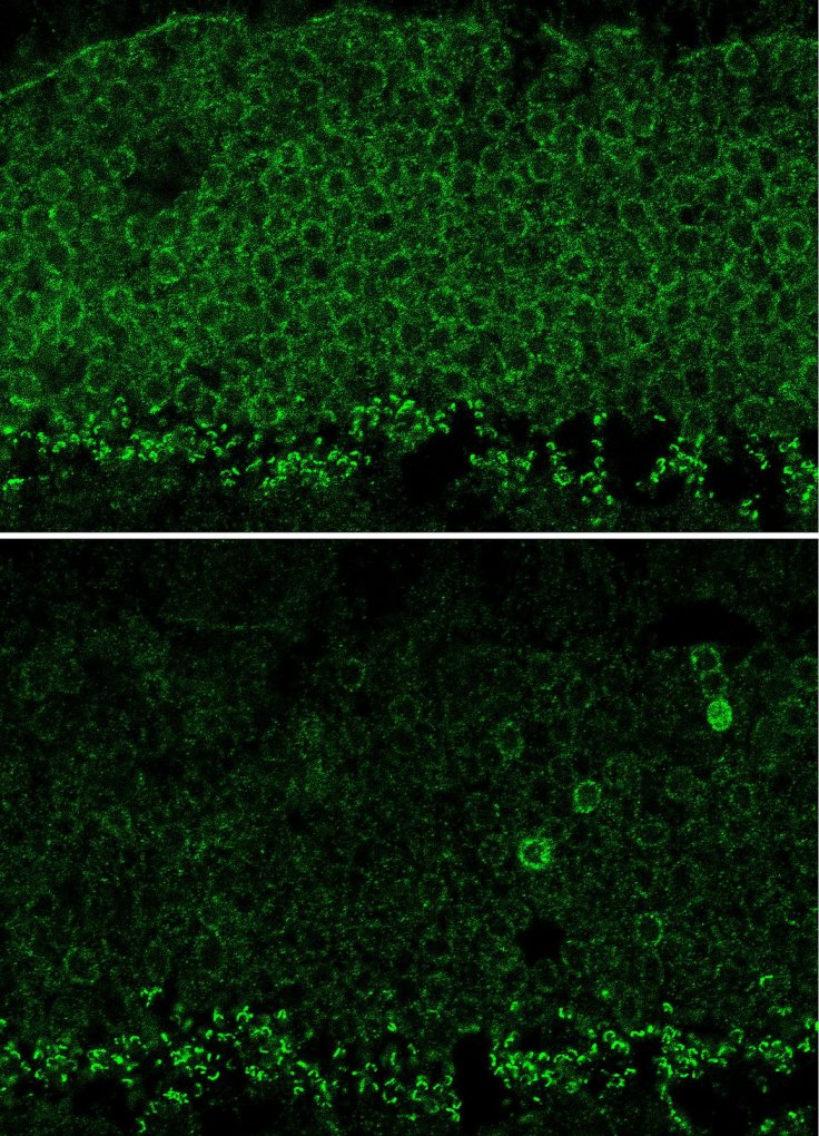 NIH-funded scientists deploy CRISPR to preserve photoreceptors in mice