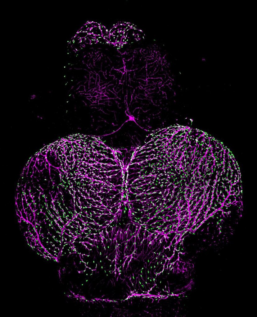 NIH researchers trace origin of blood-brain barrier ‘sentry cells’
