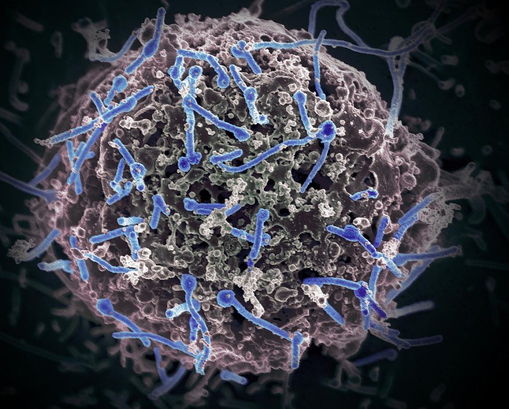 NIH study of Ebola patient traces disease progression and recovery