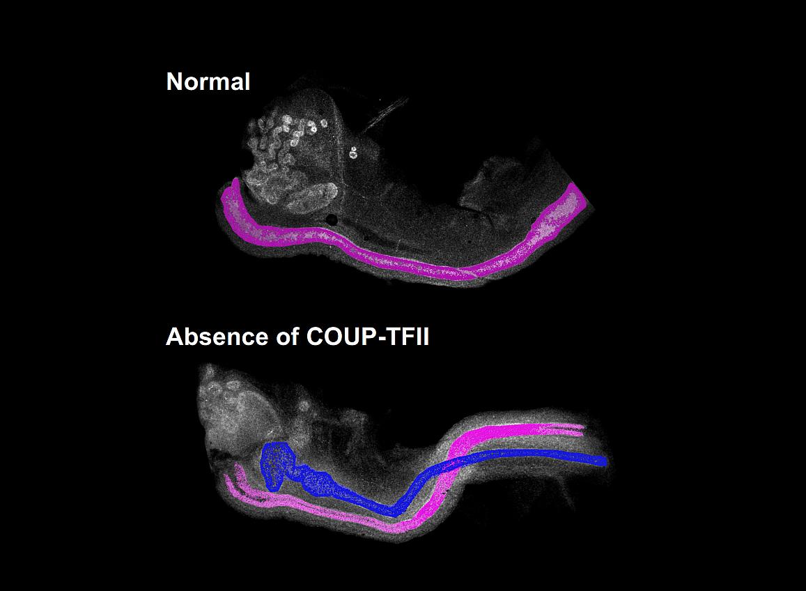 Female mouse embryos actively remove male reproductive systems