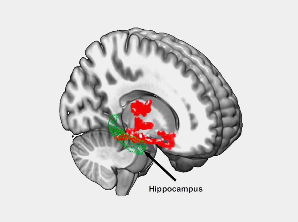 diagram of the brain highlighting the hippocampus and thalamus