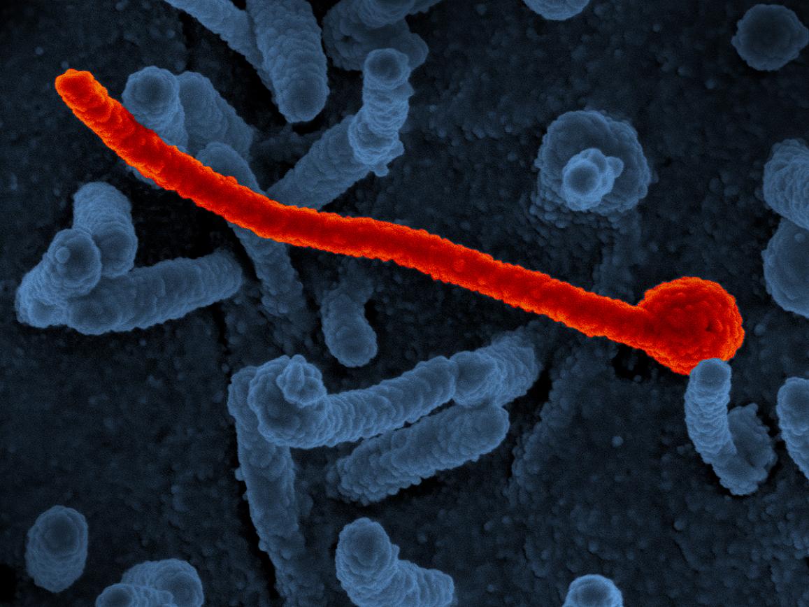 scanning electron micrograph of Ebola virus shown on the surface of Vero cells