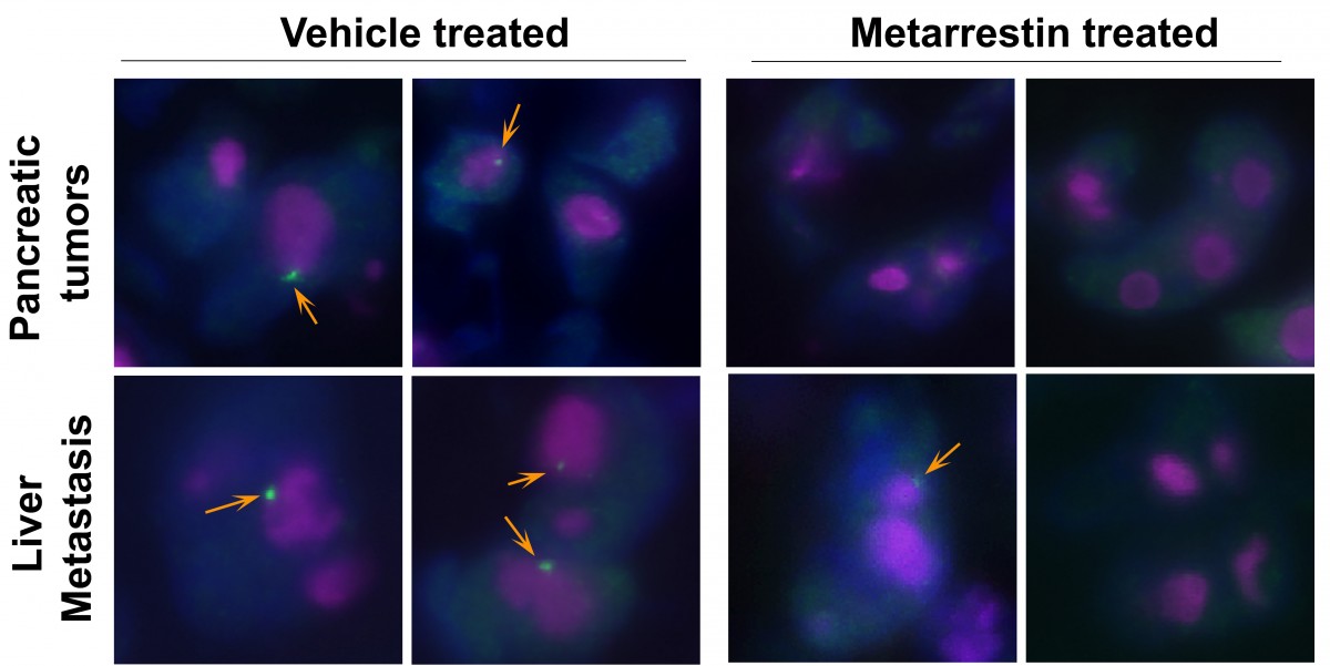 comparison of cancer cells treated with metarrestin with untreated control cells