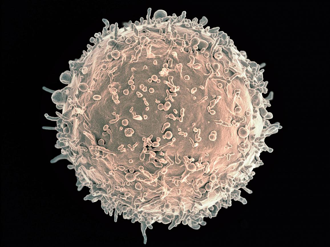 Colorized scanning electron micrograph of a B cell from a human donor