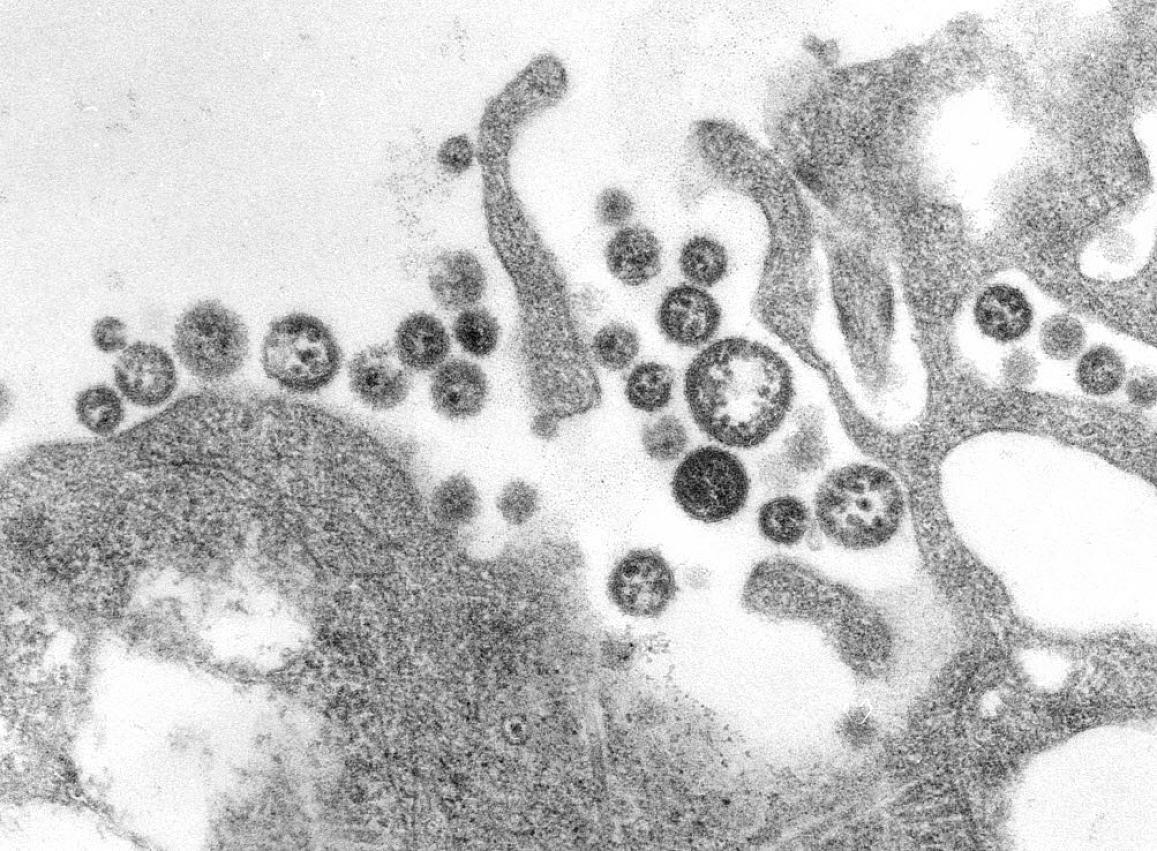 Lassa virus