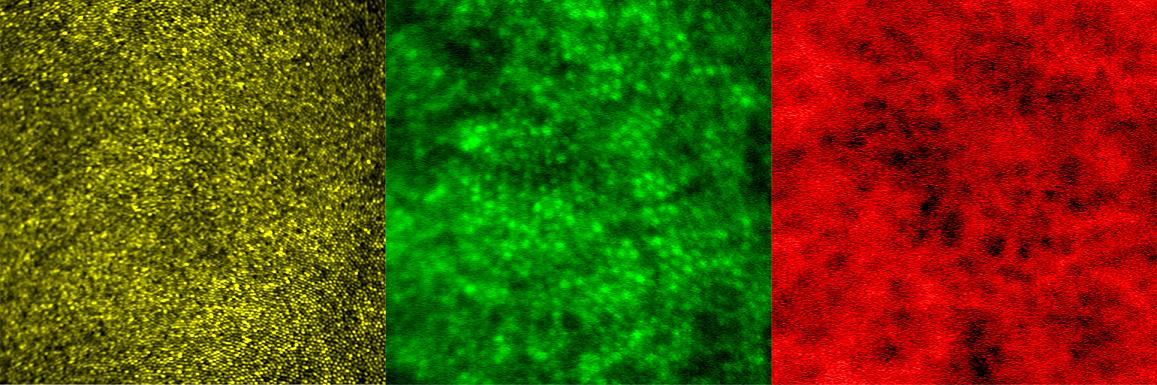 Images of photoreceptors (top), retinal pigment epithelial cells (center), and choriocapillaris in the living human eye