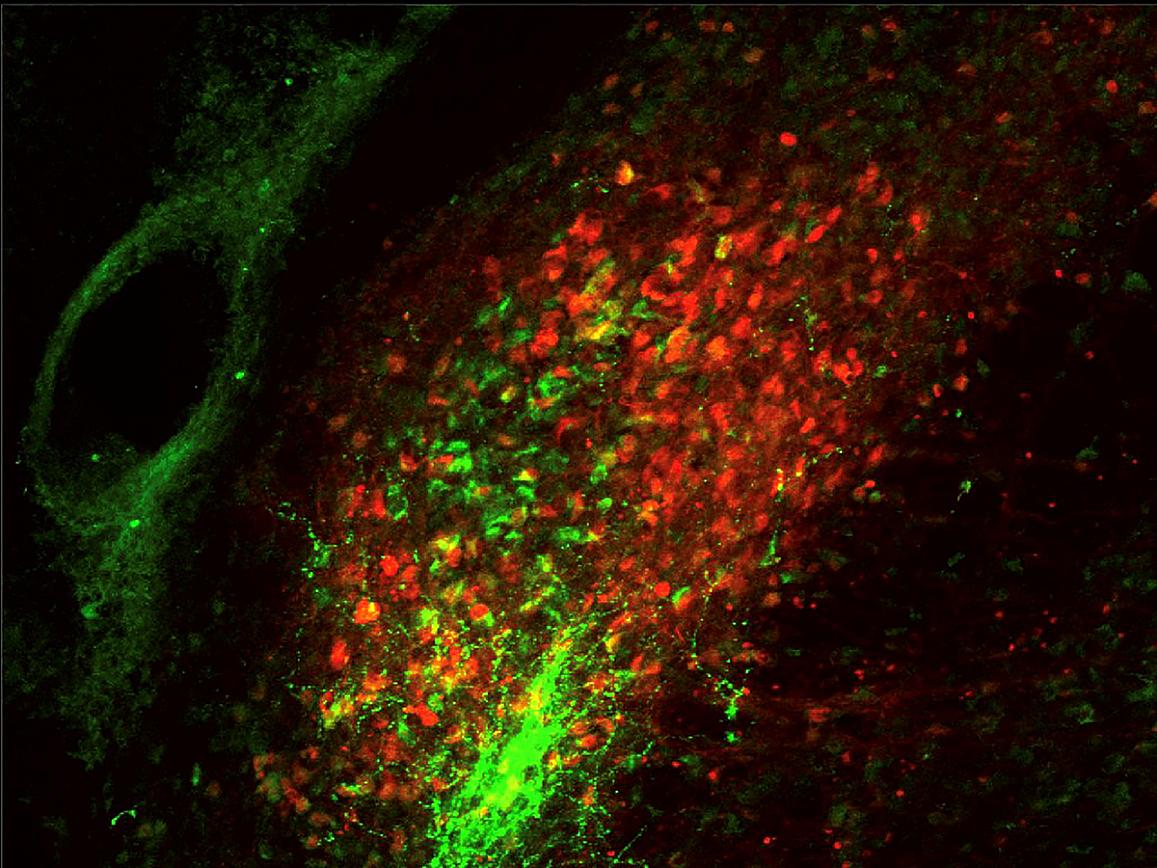Two different groups of parabrachial neurons, one expressing calcitonin gene-related peptide (green) and the other expressing substance P (red)
