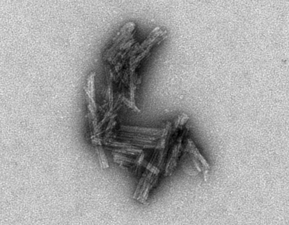 Electron micrograph of tau clusters
