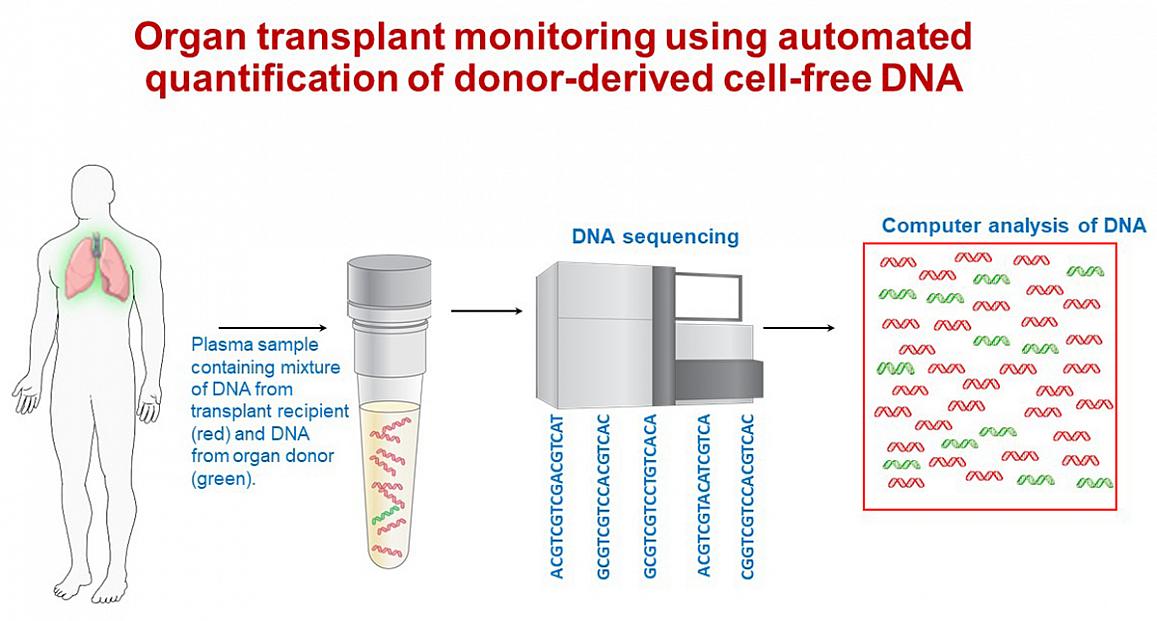 illustration of a new blood test that can identify early signs of lung transplant rejection