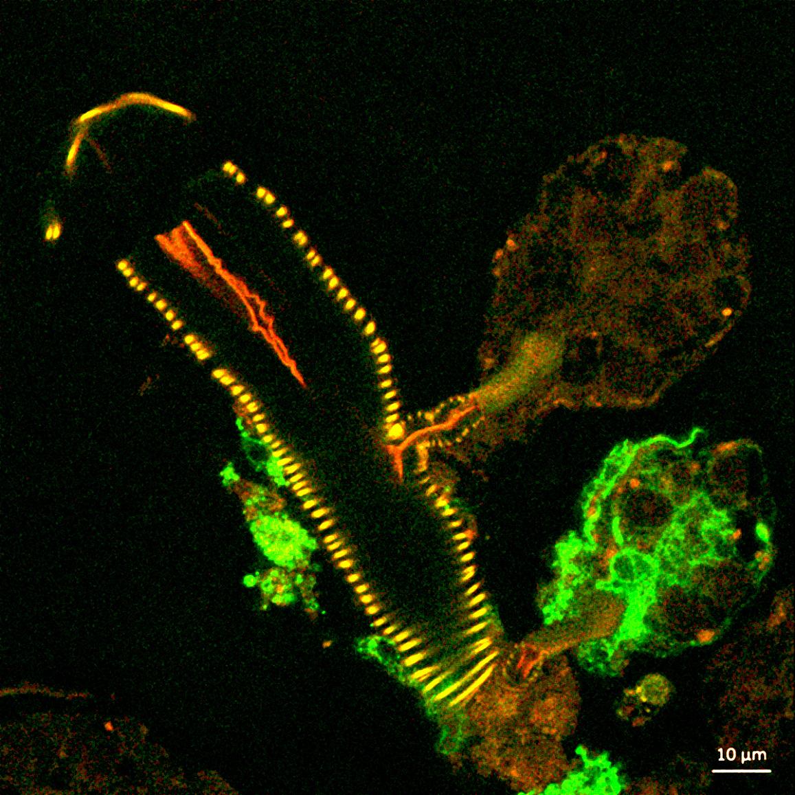 confocal microscope image showing a cross section of a tick salivary gland infected with Langat virus