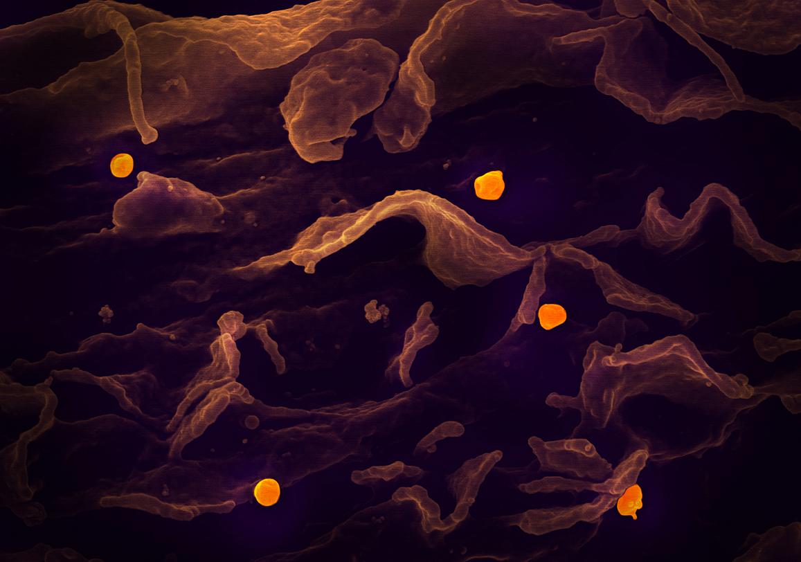 Scanning electron micrograph of Nipah virus (yellow) budding from the surface of a cell.