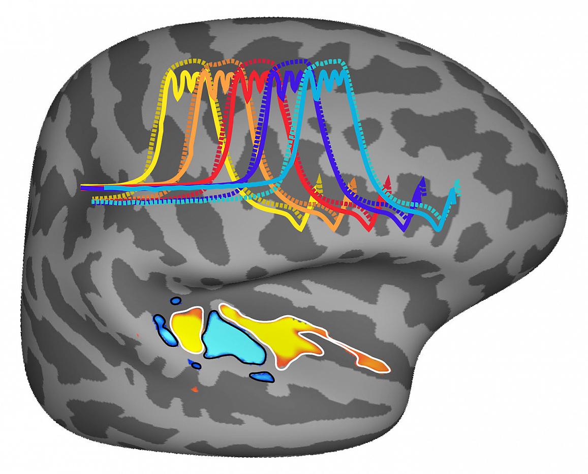 brain activity