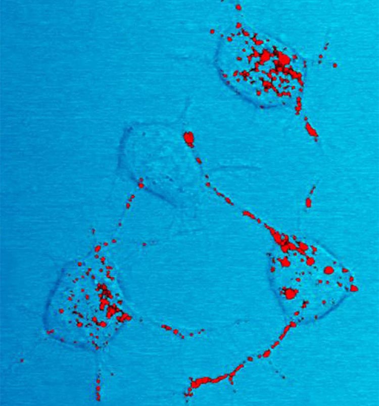 Four nerve cells in a mouse illustrate how infectious prion protein (red) moves within cells along neurites