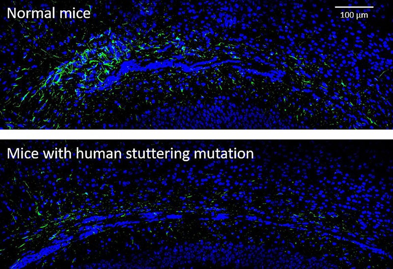 comparison of the number of brain cells called astrocytes in the brain's corpus callosum in normal mice vs a mouse model of stuttering
