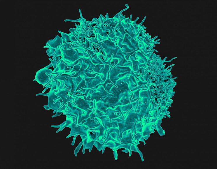 Colorized scanning electron micrograph of a T cell