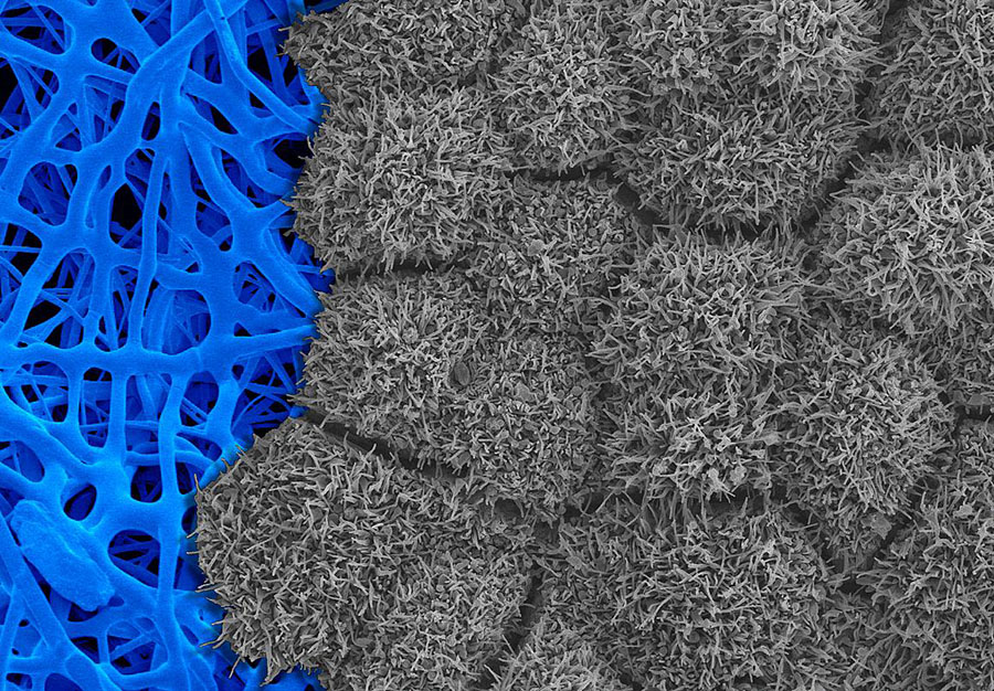 Scanning electron micrograph showing iPS cell-derived RPE tissue (gray) cultured on a fiber-based scaffold (blue)