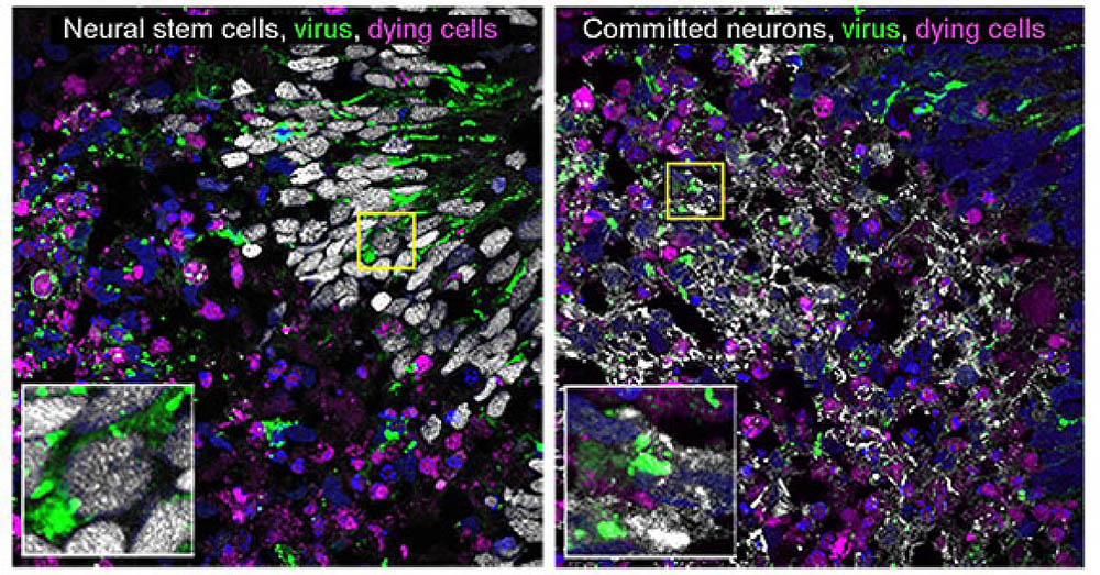 LACV-infected cerebral organoids