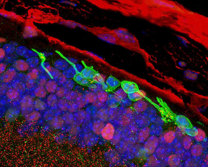 chemically induced photoreceptor-like cells (green) in the mouse retina