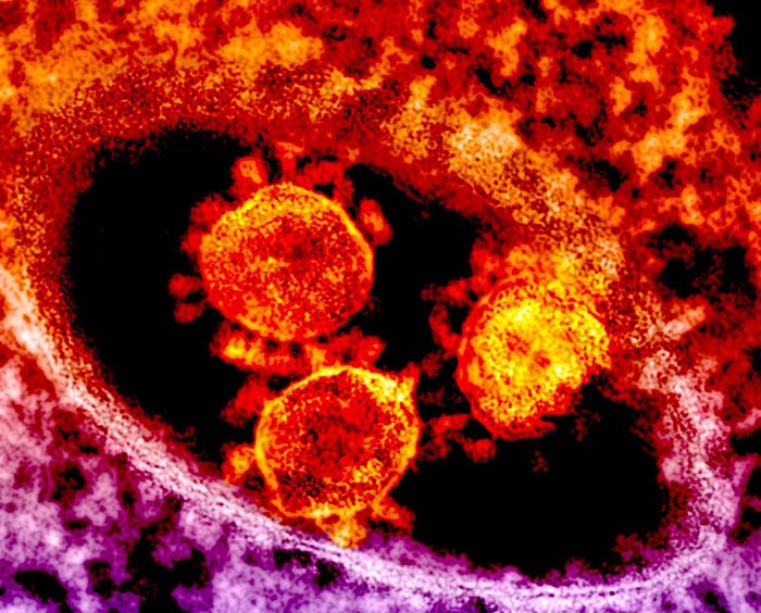 Colorized transmission electron micrograph showing particles of the Middle East Respiratory Syndrome Coronavirus