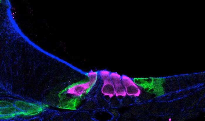 sensory hair cells (pink) in a newborn mouse cochlea