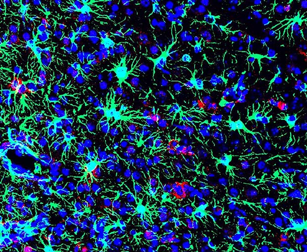 cells in a Zika-infected mouse brain