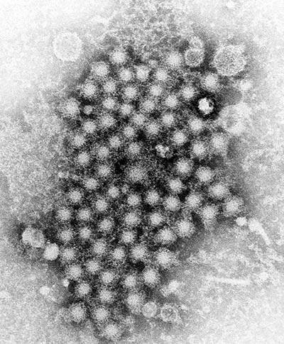 Black and white image of hepatitis virus particles that look like a mass of small round shapes