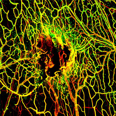 spidery wed of blood vessels