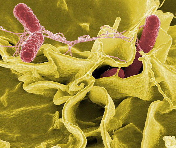 Salmonella bacteria (pink), a common cause of foodborne disease, invade a human epithelial cell (yellow)