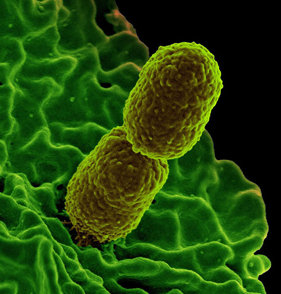 Colorized scanning electron micrograph showing carbapenem-resistant Klebsiella pneumoniae interacting with a human neutrophil